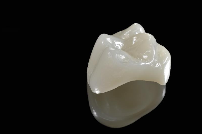 Porcelain Crowns  Pewaukee, WI 